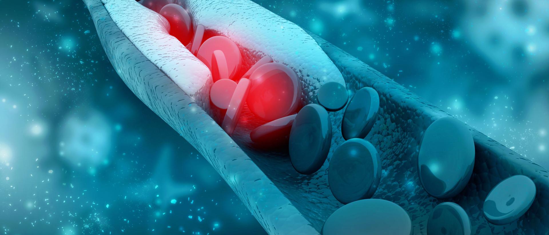 Staging the Heart: NLA and EAS Reveal a New Era of Precision Lipidology and Imaging